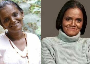 നടി മോളി കണ്ണമാലി ഗുരുതരാവസ്ഥയില്‍